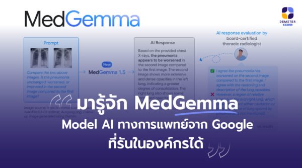 MedGemma 1.5 4B can be used to interpret a longitudinal pair of chest X-rays along