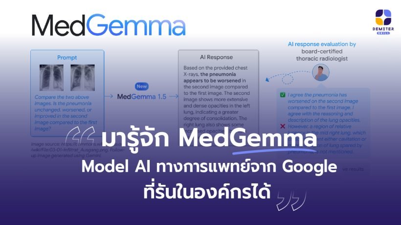 MedGemma 1.5 4B can be used to interpret a longitudinal pair of chest X-rays along