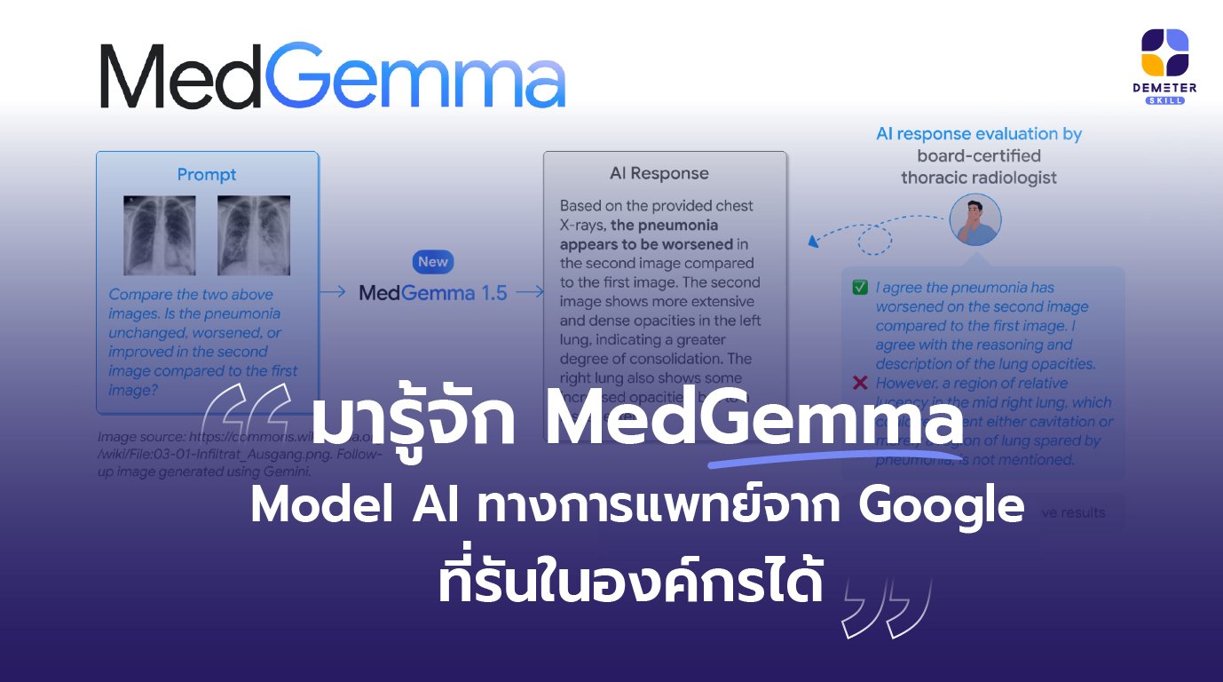 MedGemma 1.5 4B can be used to interpret a longitudinal pair of chest X-rays along